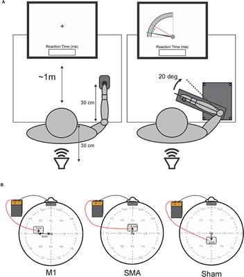 Transcranial Direct Current Stimulation Over Motor Areas Improves Reaction Time in Parkinson's Disease